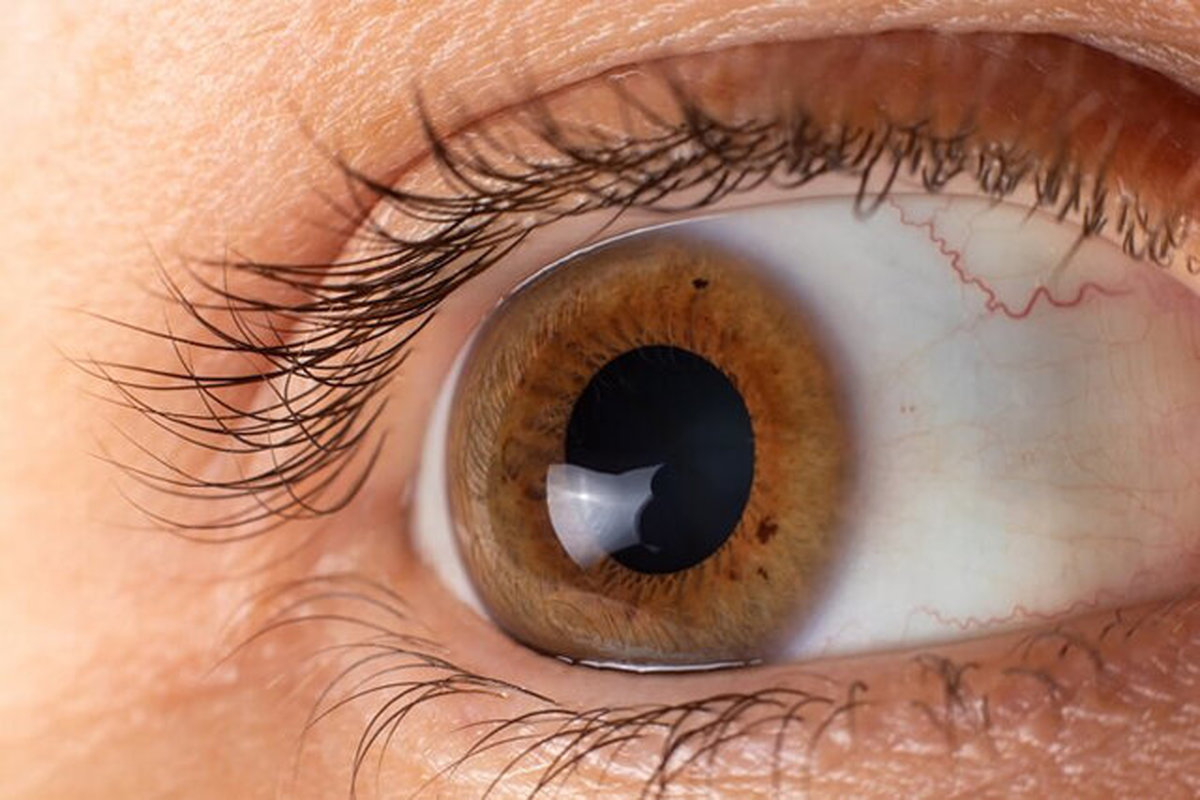 خشکی چشم با افزایش سن شیوع می‌یابد